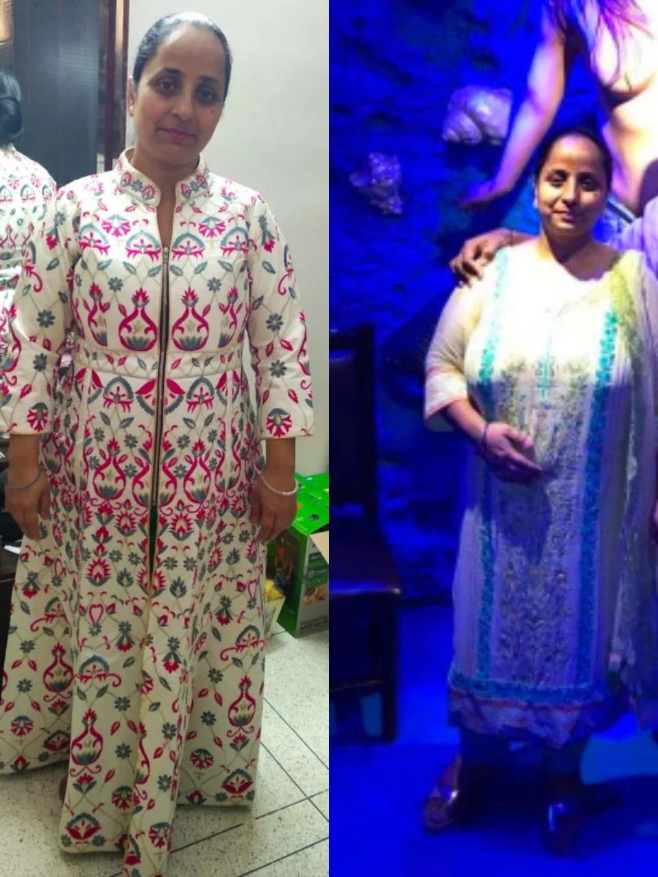 Before & After	