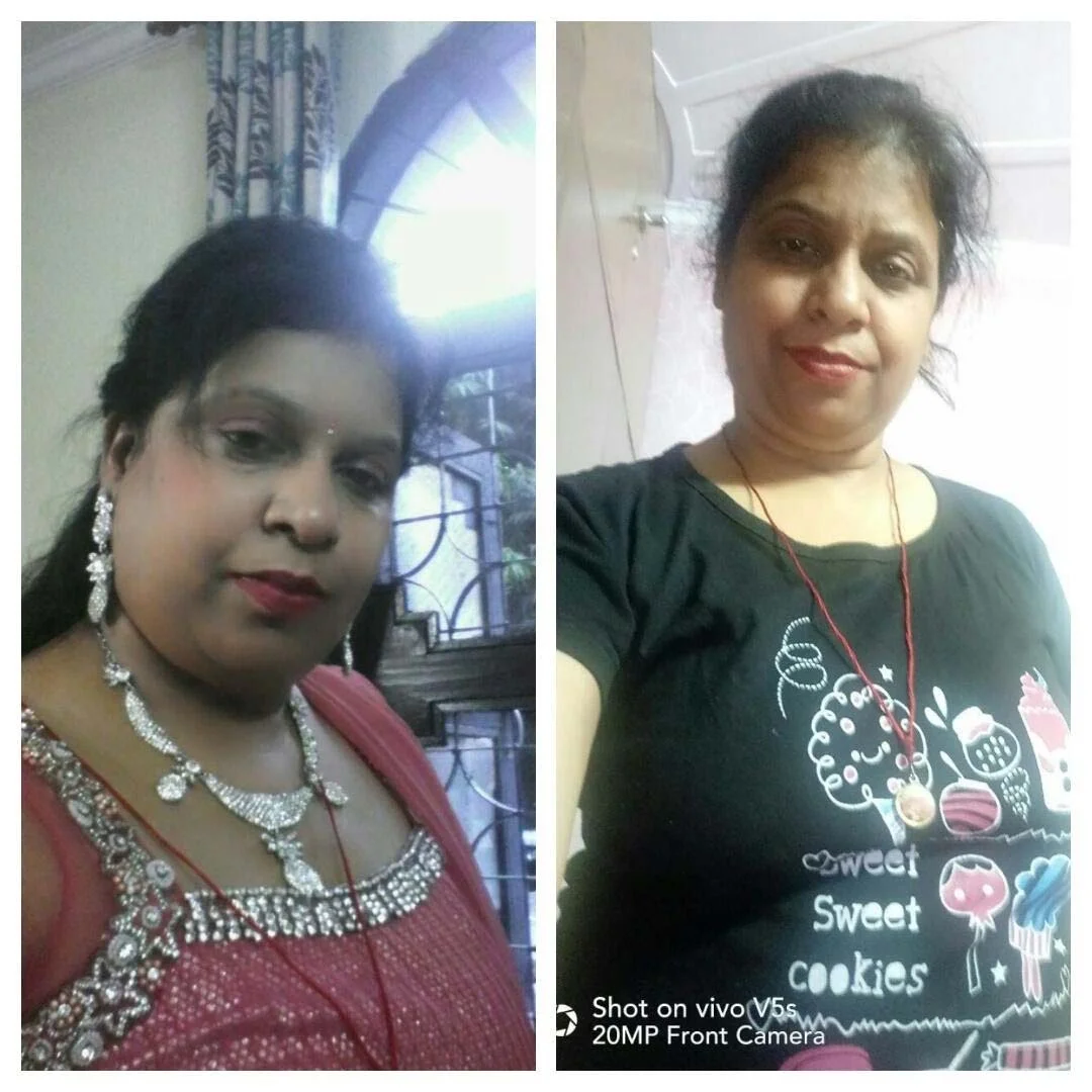 Before & After	