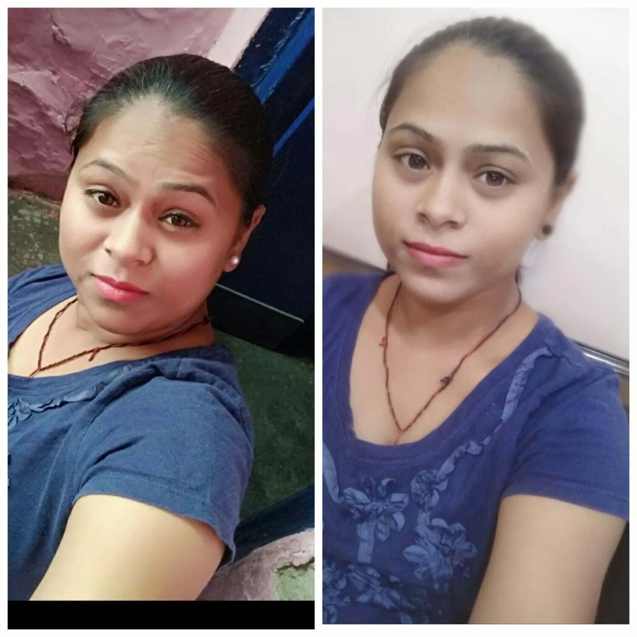 Before & After	