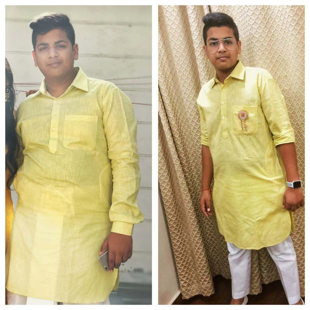 Before & After	