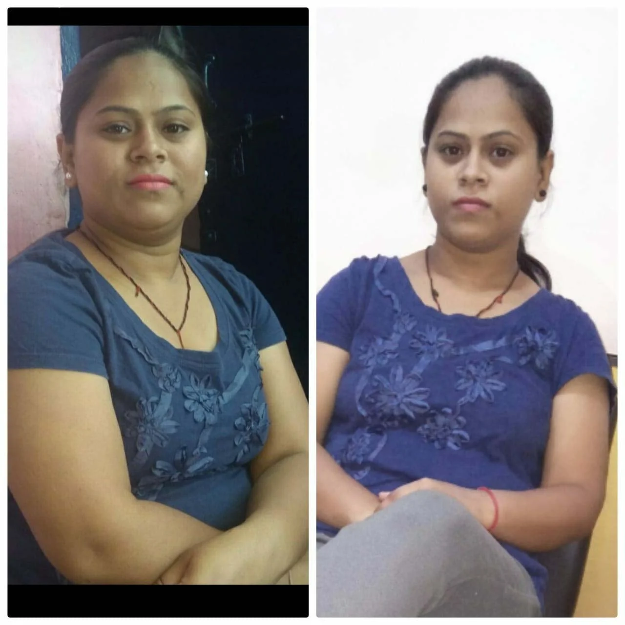 Before & After	